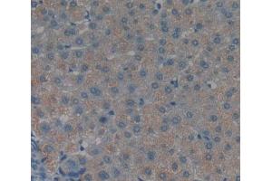 IHC-P analysis of liver tissue, with DAB staining. (TNKS2 antibody  (AA 959-1166))