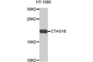 Western blot analysis of extracts of HT-1080 cells, using CTAG1B antibody. (CTAG1B antibody)