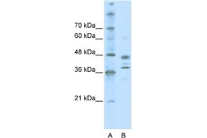 WB Suggested Anti-SMARCB1 Antibody Titration: 0. (SMARCB1 antibody  (Middle Region))