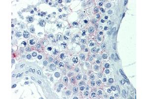 IHC-P Image Immunohistochemical analysis of paraffin-embedded human testis, using EDG7, antibody(20 μg/ml). (LPAR3 antibody)