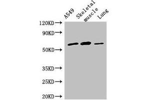 Western Blot Positive WB detected in: A549 whole cell lysate, Mouse skeletal muscle tissue, Rat lung tissue All lanes: AOAH antibody at 2. (AOAH antibody  (AA 180-254))