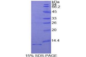 SDS-PAGE (SDS) image for Interleukin 1 Receptor, Type I (IL1R1) (AA 21-109) protein (His tag) (ABIN1170731)