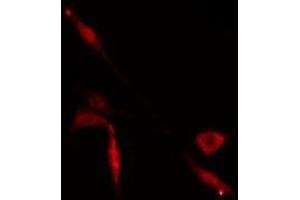 ABIN6274929 staining  Hela cells by IF/ICC. (BAZ2A antibody  (N-Term))