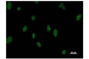 Immunostaining analysis in HeLa cells. (DDX5 antibody)