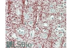 ABIN571099 (3. (Tppp antibody  (Internal Region))