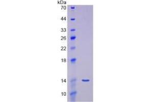 Image no. 1 for Myostatin (MSTN) (AA 267-375) (Active) protein (His tag) (ABIN6239911)