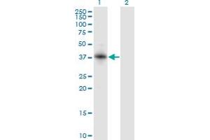Western Blot analysis of RNF150 expression in transfected 293T cell line by RNF150 monoclonal antibody (M01), clone 5D11. (RNF150 antibody  (AA 67-176))