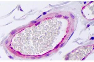 Anti-SERPINE1 / PAI-1 antibody IHC staining of human vascular endothelium. (PAI1 antibody)