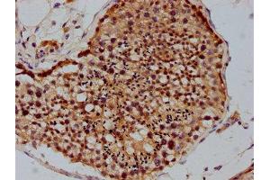 IHC image of ABIN7142212 diluted at 1:100 and staining in paraffin-embedded human testis tissue performed on a Leica BondTM system. (PSMD4/ASF antibody  (Regulatory Subunit 4))
