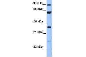 WB Suggested Anti-CCDC7 Antibody Titration: 0. (CCDC7 antibody  (N-Term))