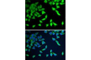 Immunofluorescence analysis of A-549 cells using WDR77 antibody (ABIN6128227, ABIN6150205, ABIN6150206 and ABIN6222948).
