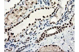 Immunohistochemical staining of paraffin-embedded Human Kidney tissue using anti-NMNAT1 mouse monoclonal antibody. (NMNAT1 antibody)