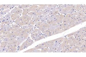 Detection of FKBP1A in Human Cardiac Muscle Tissue using Polyclonal Antibody to FK506 Binding Protein 1A (FKBP1A) (FKBP1A antibody  (AA 2-108))