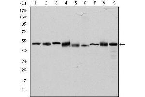Western blot analysis using CCT2 mouse mAb against Hela (1), MCF-7 (2), Jurkat (3), T47D (4), K562 (5), A431 (6), NIH/3T3 (7), PC-12 (8) and Cos7 (9) cell lysate. (CCT2 antibody)