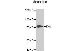 Western blot analysis of extracts of mouse liver, using FN1 antibody. (Fibronectin 1 antibody)