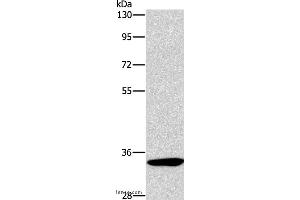 Western blot analysis of Mouse kidney tissue, using NCR1 Polyclonal Antibody at dilution of 1:450