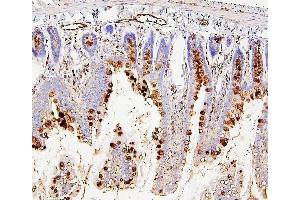 IHC analysis of RAB27A using anti-RAB27A antibody (ABIN7602714). (RAB27A antibody  (AA 98-216))