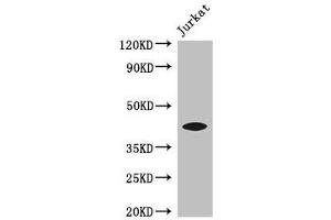 Western Blot Positive WB detected in: Jurkat whole cell lysate All lanes: FOXQ1 antibody at 3 μg/mL Secondary Goat polyclonal to rabbit IgG at 1/50000 dilution Predicted band size: 42 kDa Observed band size: 42 kDa