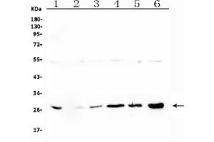 Western blot analysis of LRTOMT using anti-LRTOMT antibody (ABIN7602986). (Leucine Rich Transmembrane and 0-Methyltransferase Domain Containing (LRTOMT) (Middle Region) antibody)