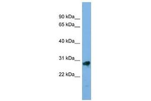 KLK13 antibody used at 1 ug/ml to detect target protein. (Kallikrein 13 antibody  (Middle Region))
