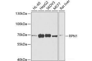 Western blot analysis of extracts of various cell lines using RPN1 Polyclonal Antibody at dilution of 1:1000. (RPN1 antibody)