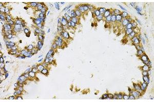 Immunohistochemistry of paraffin-embedded Human prostate using EFNA1 Polyclonal Antibody at dilution of 1:100 (40x lens). (Ephrin A1 antibody)