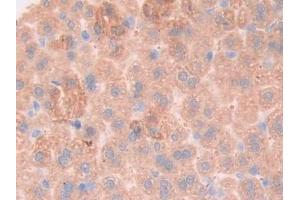 Detection of gp130 in Mouse Liver Tissue using Polyclonal Antibody to Glycoprotein 130 (gp130) (CD130/gp130 antibody  (AA 238-500))