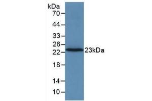 Detection of Recombinant F2, Rat using Monoclonal Antibody to Coagulation Factor II (F2) (Prothrombin antibody  (AA 44-200))