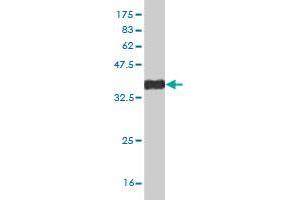 Western Blot detection against Immunogen (38. (DLX2 antibody  (AA 1-110))