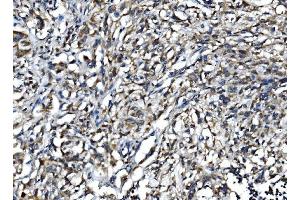 IHC analysis of IL15 using anti-IL15 antibody (ABIN7602347).