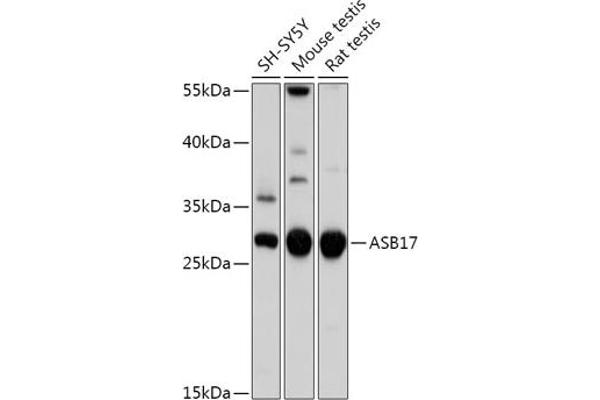 ASB17 Antikörper  (AA 30-130)
