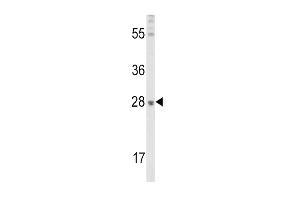 Western blot analysis of FGF10 Antibody (C-term) (ABIN392510 and ABIN2842073) in mouse lung tissue lysates (35 μg/lane). (FGF10 antibody  (C-Term))