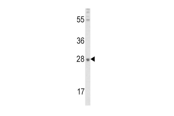 FGF10 antibody  (C-Term)