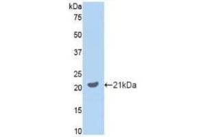 Detection of Recombinant GAS6, Mouse using Polyclonal Antibody to Growth Arrest Specific Protein 6 (GAS6) (GAS6 antibody  (AA 483-646))