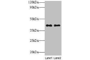 Western blot All lanes: QPCT antibody at 2 μg/mL Lane 1: Rat muscle tissue Lane 2: Rat adrenal gland tissue Secondary Goat polyclonal to rabbit IgG at 1/10000 dilution Predicted band size: 41, 36 kDa Observed band size: 41 kDa (QPCT antibody  (AA 29-361))