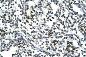 Image no. 1 for anti-Sirtuin 5 (SIRT5) (AA 184-233) antibody (ABIN202189) (SIRT5 antibody  (AA 184-233))