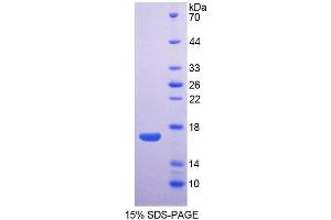 SDS-PAGE analysis of Rabbit AQP1 Protein. (Aquaporin 1 Protein)
