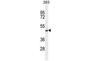 COCH Antibody (C-term) western blot analysis in 293 cell line lysates (35µg/lane). (COCH antibody  (C-Term))