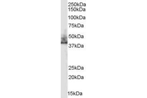 SLC9A3R2 antibody  (Internal Region)