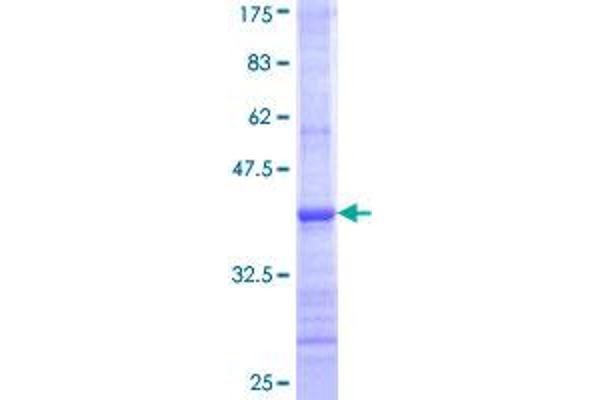 UGT2B7 Protein (AA 69-157) (GST tag)