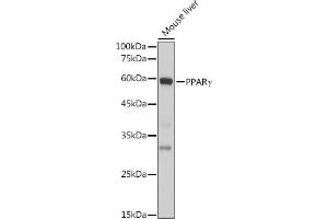 Western blot analysis of extracts of Mouse liver, using PPARγ antibody (ABIN6134090, ABIN6146004, ABIN6146006 and ABIN6215096) at 1:1000 dilution. (PPARG antibody  (AA 70-170))
