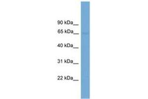 Image no. 1 for anti-Interleukin 1 Receptor-Like 2 (IL1RL2) (AA 107-156) antibody (ABIN6745601) (IL1RL2 antibody  (AA 107-156))