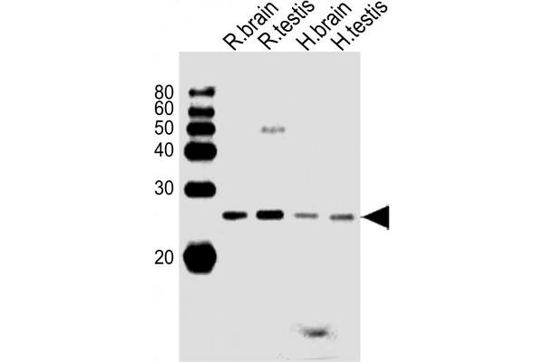 RAB11B anticorps  (C-Term)