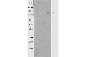 Western blot analysis of extracts of HepG2, using THBS1 antibody. (Thrombospondin 1 antibody  (Internal Region))