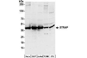 anti-Serine/threonine Kinase Receptor Associated Protein (STRAP) (AA 300-350) antibody