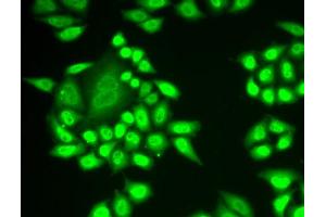 Immunofluorescence analysis of MCF-7 cell using RNF40 antibody. (RNF40 antibody)