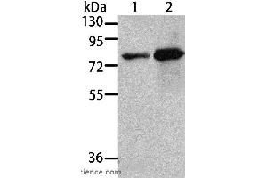 Western blot analysis of 293T and A431 cell, using MSN Polyclonal Antibody at dilution of 1:500 (Moesin antibody)