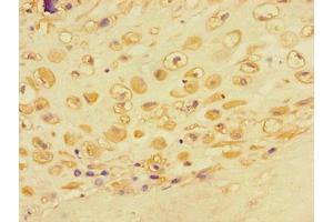 Immunohistochemistry of paraffin-embedded human placental tissue using ABIN7143102 at dilution of 1:100 (ACTR3 antibody  (AA 352-409))