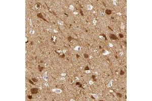 Immunohistochemical staining of human cerebral cortex with DLG3 polyclonal antibody  shows distinct nuclear and cytoplasmic positivity in neuronal cells at 1:50-1:200 dilution. (DLG3 antibody)
