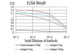 Black line: Control Antigen (100 ng),Purple line: Antigen (10 ng), Blue line: Antigen (50 ng), Red line:Antigen (100 ng)